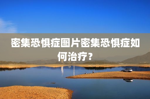密集恐惧症图片密集恐惧症如何治疗？